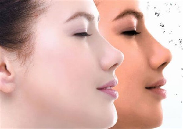 晒太阳脸上长斑怎么办 护肤 第1张 晒太阳脸上长斑怎么办 护肤 第1张