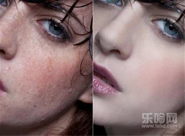 光子祛斑后如何保养 护肤 第4张