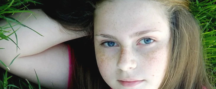 鸡蛋美容祛斑方法 鸡蛋 祛斑 美妆 第3张