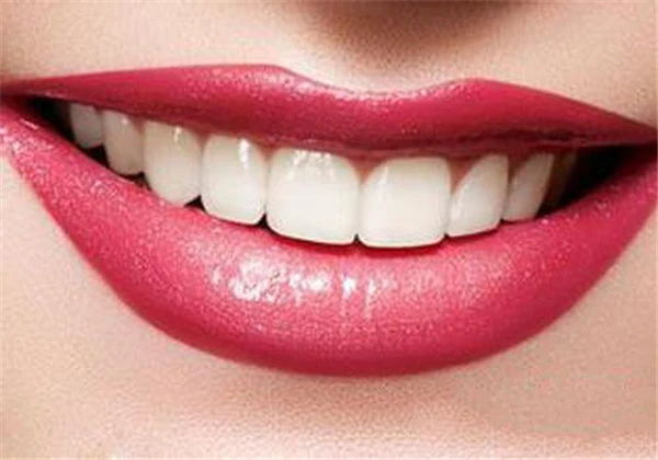 烤瓷牙可以取下来吗 护肤 第6张 烤瓷牙可以取下来吗 护肤 第6张