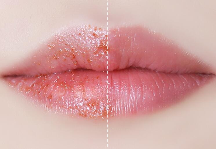 唇色深怎么办,盘点淡化深唇色有效方法 唇色 改变唇色深 改变唇色深有效方法盘点 美妆 第1张 唇色深怎么办,盘点淡化深唇色有效方法 唇色 改变唇色深 改变唇色深有效方法盘点 美妆 第1张