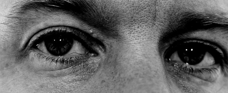 怎样去除脸上老年斑 老年斑 美妆 第3张