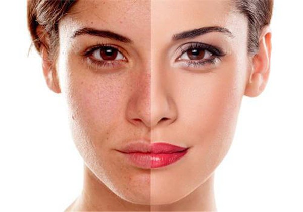 削骨后老了会怎样 护肤 第1张