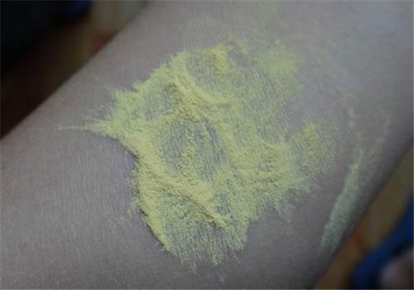 松花粉可以去痘吗，什么人不能用松花粉去痘 护肤 第1张