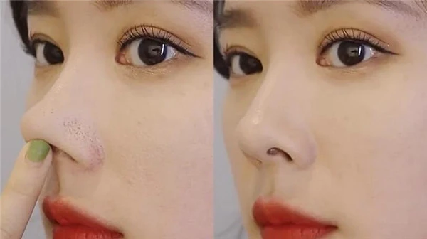 肤色不均、黑眼圈的遮瑕技巧，让底妆更贴肤的遮瑕工具 黑眼圈 遮瑕技巧 第4张