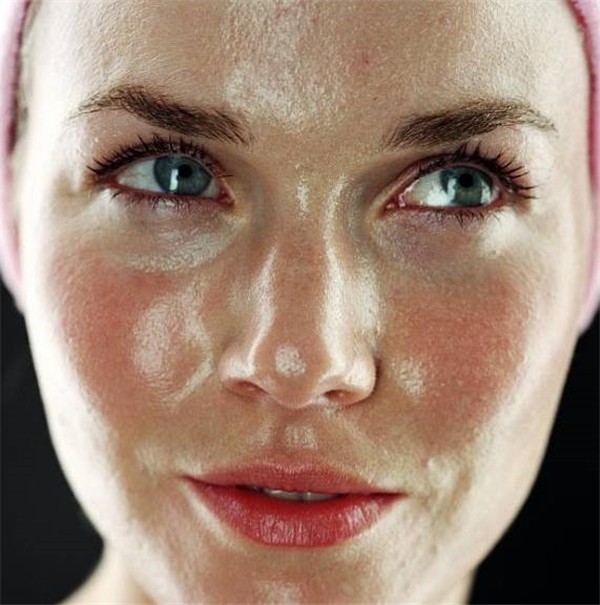 皮肤容易出油怎么调理 出油 皮肤出油 美妆 第1张