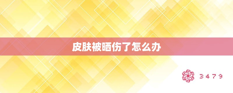 皮肤被晒伤了怎么办