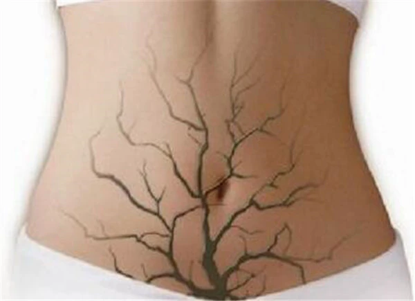 怎么给皮肤排毒最有效,这10个排毒方法一定要收藏! 护肤 第8张 怎么给皮肤排毒最有效,这10个排毒方法一定要收藏! 护肤 第8张