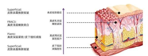 Fotona,4D,Pro,为什么那么火,更适合敏感肌肤能量更高 Fotona 4D Pro 敏感肌肤 第3张 Fotona,4D,Pro,为什么那么火,更适合敏感肌肤能量更高 Fotona 4D Pro 敏感肌肤 第3张