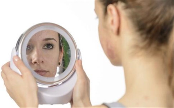 消除黑头有哪些方法,怎样在在最大程度上避免黑头的出现 黑头 方法 第2张 消除黑头有哪些方法,怎样在在最大程度上避免黑头的出现 黑头 方法 第2张