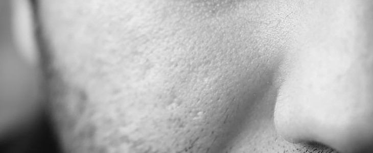 面部毛孔粗大怎么办 面部 毛孔粗大 美妆 第1张