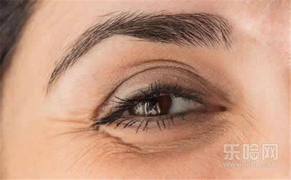 眼角纹是怎么形成的 护肤 第7张
