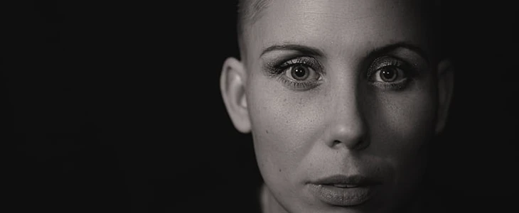 怎么预防色斑 预防 色斑 美妆 第2张