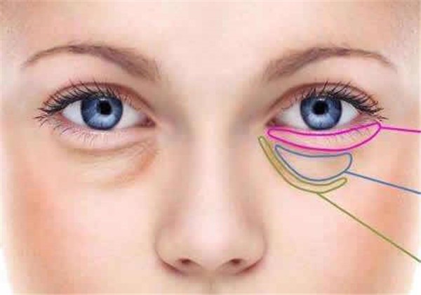下眼袋可以去掉吗，只要发现的早，去除下眼袋就不是梦想！ 护肤 第1张