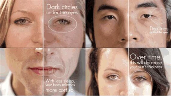 Fotona,4D,Pro,为什么那么火,更适合敏感肌肤能量更高 Fotona 4D Pro 敏感肌肤 第2张 Fotona,4D,Pro,为什么那么火,更适合敏感肌肤能量更高 Fotona 4D Pro 敏感肌肤 第2张