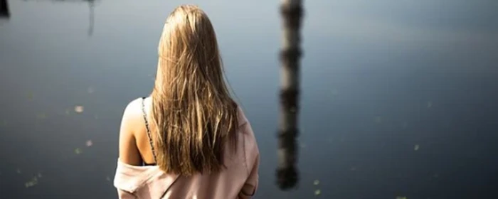 油脂性脱发怎么办 油脂性脱发 美妆 第2张