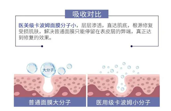 MEXQ美皙泉卡波姆面膜权威认证，引领护肤新浪潮 MEXQ 美皙泉 卡波姆面膜 美妆 第6张