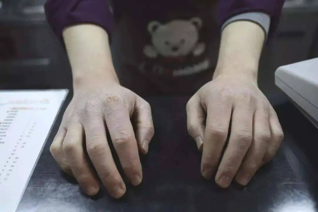 资生堂红罐护手霜包装质朴滋润度超高 资生堂 护手霜 第2张