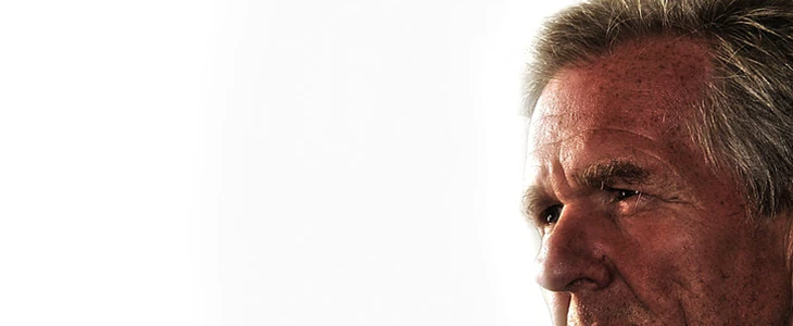 怎样去除脸上老年斑 老年斑 美妆 第2张