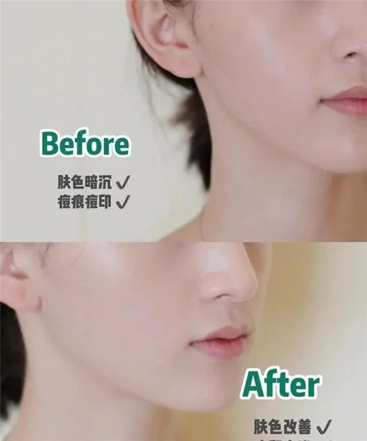 贵妇精华难怪好用,成分顶级不说,效果还明显,坚持用效果不会差 精华 第7张 贵妇精华难怪好用,成分顶级不说,效果还明显,坚持用效果不会差 精华 第7张