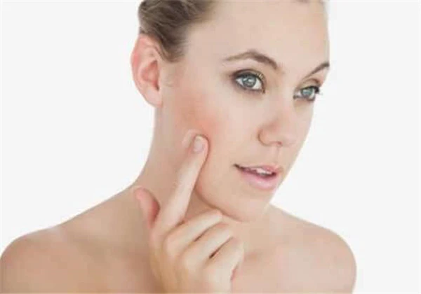 激光祛斑后反黑怎么办 护肤 第2张