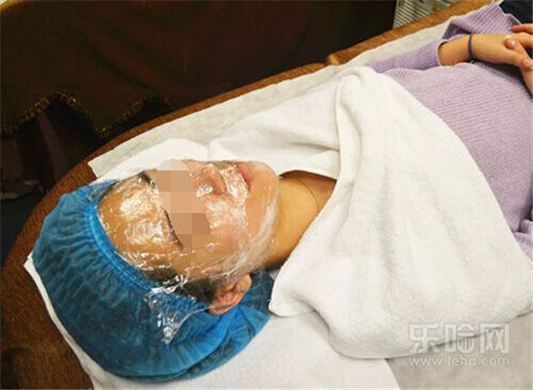 镭射净肤过程图 护肤 第2张