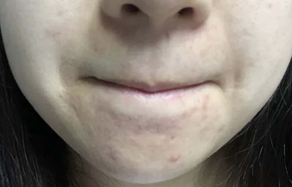 理肤泉k乳怎么样，理肤泉k乳使用测评 理肤泉 k乳 第6张