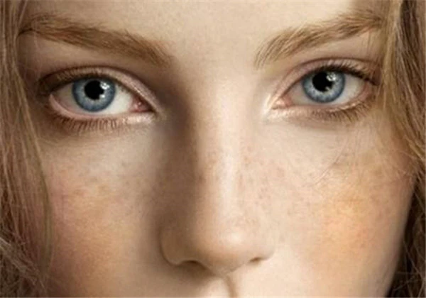 脸上长斑是什么原因 护肤 第2张 脸上长斑是什么原因 护肤 第2张