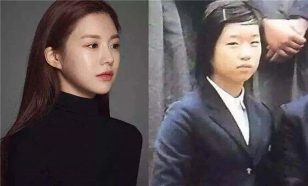 如何选择合适的双眼皮类型，双眼皮的种类 双眼皮 第3张