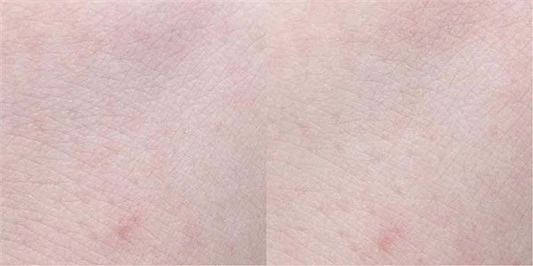 sum苏秘37水漾沁润保湿睡眠面膜怎么样,sum苏秘37水漾沁润保湿睡眠面膜使用评测 sum37 苏秘 面膜 第5张 sum苏秘37水漾沁润保湿睡眠面膜怎么样,sum苏秘37水漾沁润保湿睡眠面膜使用评测 sum37 苏秘 面膜 第5张