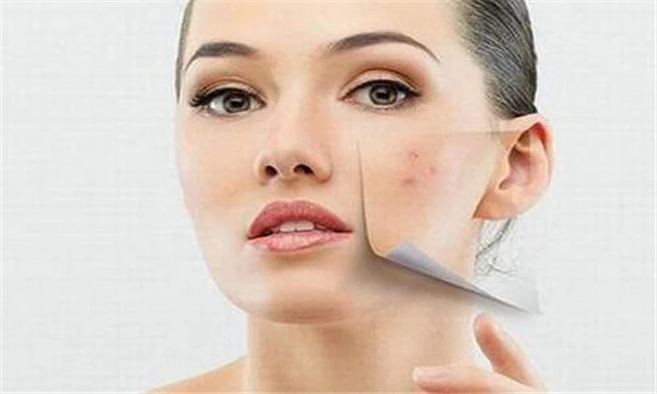 熬夜脸上长痘痘怎么可以消除 护肤 第3张 熬夜脸上长痘痘怎么可以消除 护肤 第3张