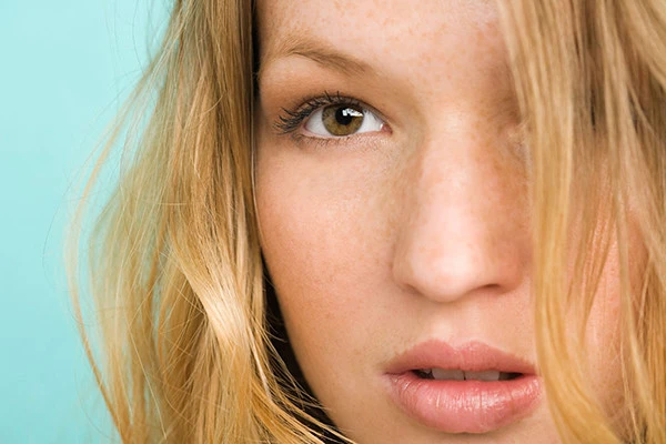 女人生完孩子为什么脸上会长斑 皮肤 第2张