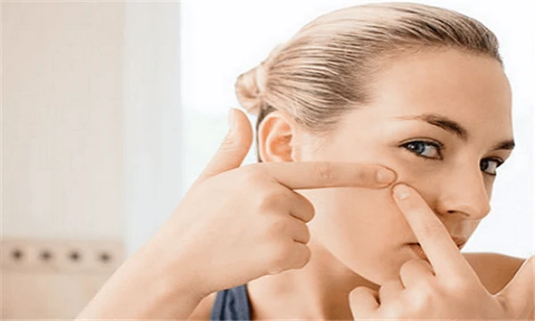 熬夜脸上长痘痘怎么可以消除 护肤 第5张 熬夜脸上长痘痘怎么可以消除 护肤 第5张