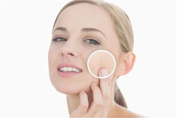 冬季皮肤干裂多喝水，蜂蜜红枣水滋阴润肺调理脸色 冬季 皮肤 第2张