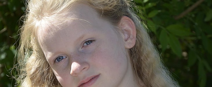 鸡蛋美容祛斑方法 鸡蛋 祛斑 美妆 第2张