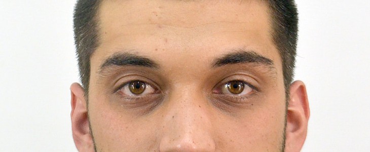 怎么样才能去除黑眼圈 黑眼圈 美妆 第3张