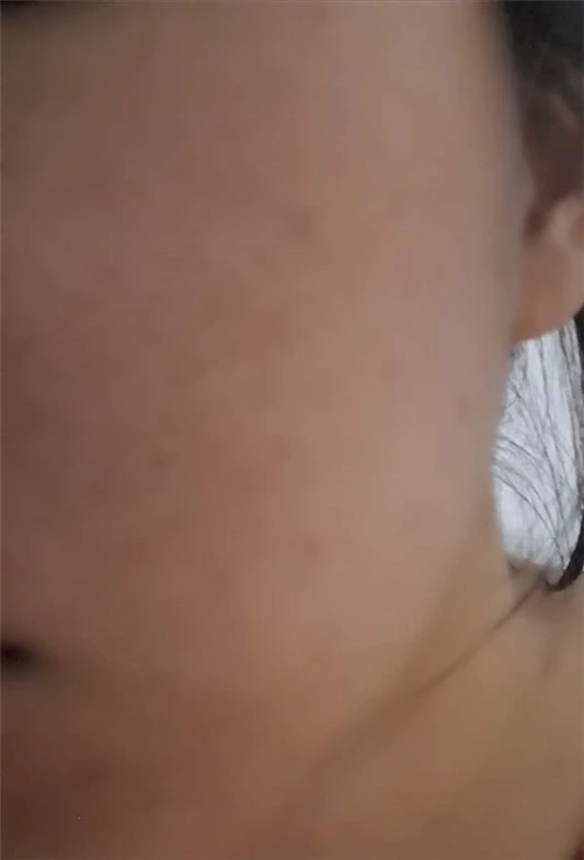 薇诺娜舒敏保湿修红霜适合什么肤质，薇诺娜舒敏保湿修红霜使用评测 薇诺娜 面霜 第7张