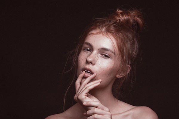 脸上长斑的原因有哪些，斑是怎么长出来的 皮肤 第1张