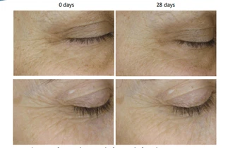 SOS六胜肽安瓶超强抗氧化功效深受消费者喜爱 SOS六胜肽安瓶 第18张