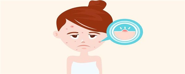 粉刺臭臭的是什么原因，有没有什么面膜可以把粉刺吸了 护肤 第1张