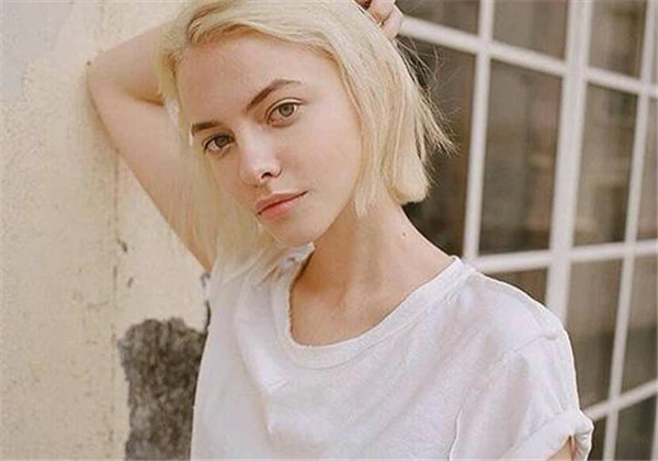 假体隆鼻能保持多久 护肤 第3张