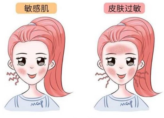 怎样判断自己是敏感肌 敏感肌 判断敏感肌 美妆 第1张