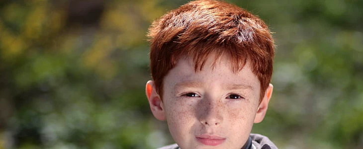 吃西红柿可以祛斑吗 西红柿 祛斑 美妆 第2张