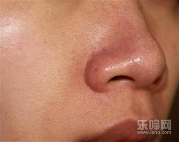 黑头多久清理一次 护肤 第1张