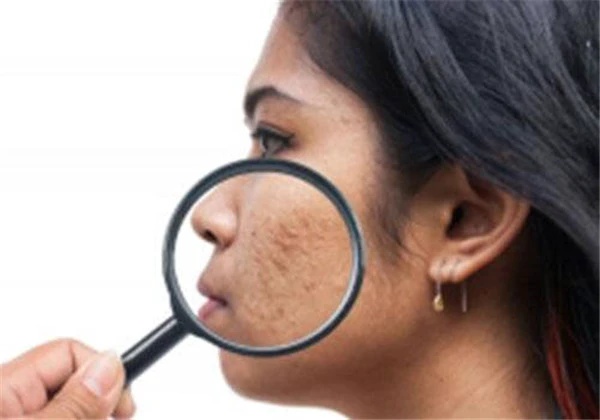 皮肤暗淡无光泽是什么原因 护肤 第4张