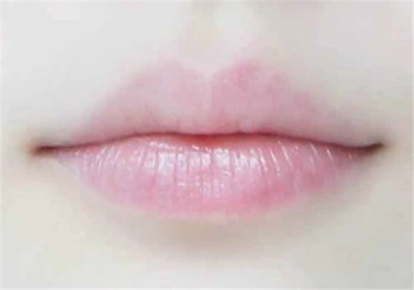 贴唇膜嘴巴疼是怎么回事，贴唇膜时嘴巴疼怎么办 护肤 第5张