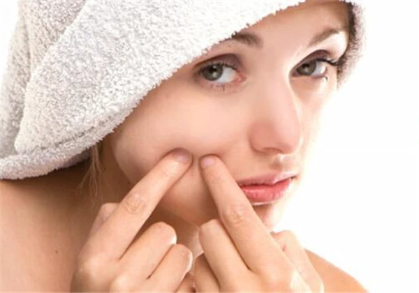 挤痘痘挤出来的是什么 护肤 第2张