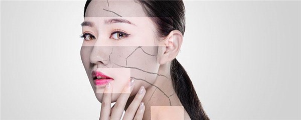 皮肤变干燥是什么原因，皮肤变干燥是什么导致的 护肤 第1张