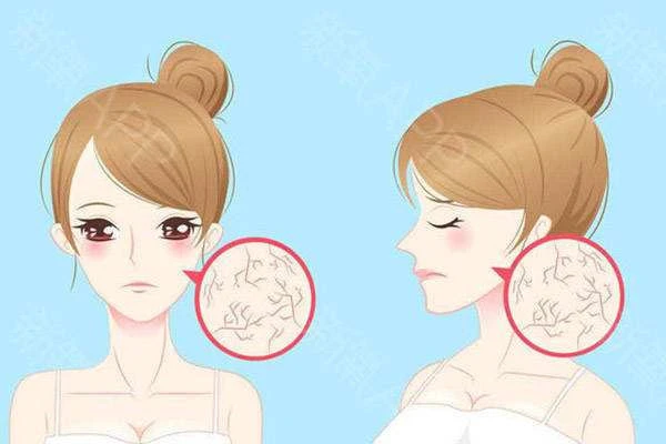 皮肤干燥发痒用维生素E，2个月皮肤就变好 皮肤 第2张