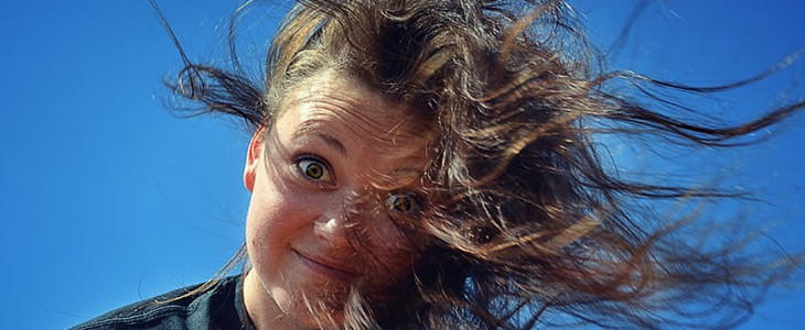 额头皮肤松弛怎么办 额头皮肤松弛 美妆 第1张